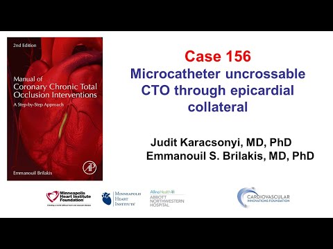 Case 156: Manual of CTO PCI - Epicardial tip in