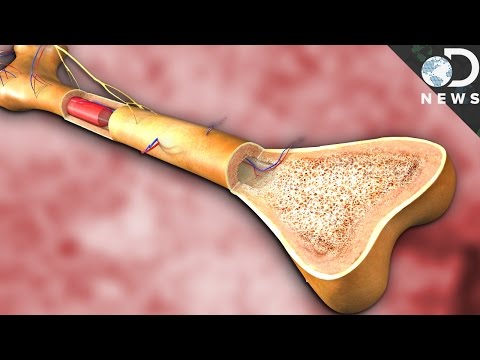 Total Hip Replacement Educational Video