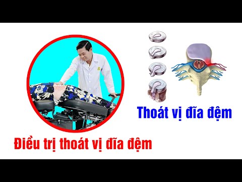 ĐIỀU TRỊ THOÁT VỊ ĐĨA ĐỆM  - KHÔNG DÙNG THUỐC & KHÔNG PHẪU THUẬT