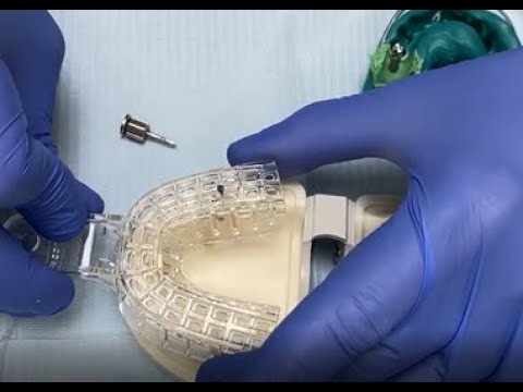 Dental Implant Impressions Analog Technique Osstem