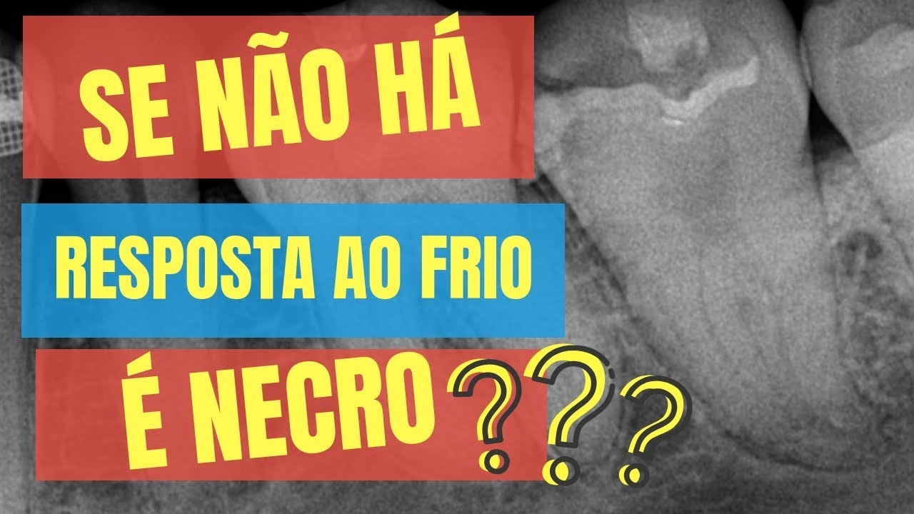 QUAL A CHANCE DE UM DENTE QUE NÃO RESPONDE AO FRIO ESTAR NECROSADO? - QUICK TIP ENDOLOVERS