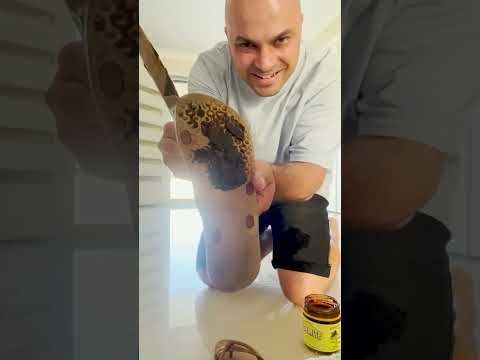 How to Annoy Your Partner