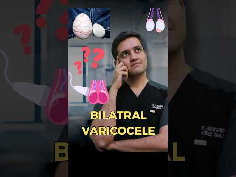 Can Embolisation Possible In Case of  Bilateral Varicocele ?