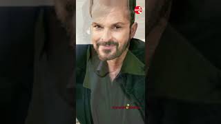 𝗠𝗜𝗚𝗨𝗘𝗟 𝗕𝗢𝗦É ⭐ Antes y Después #Shorts 🛑