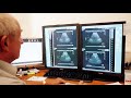 Dr. med. Wolfgang Rahn Ihre Radiologie in Villingen-Schwenningen