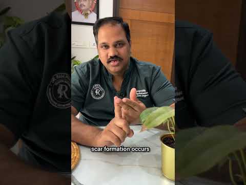Massage after gynecomastia surgery video by Dr. Ram Prabhu.