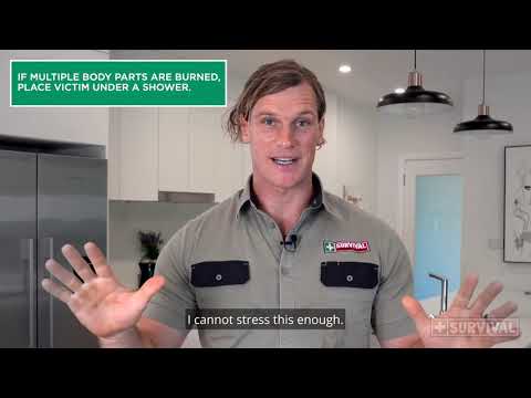 First Aid Tips: Burns & Scalds