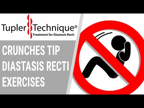 Crunches Tip diastasis recti exercises