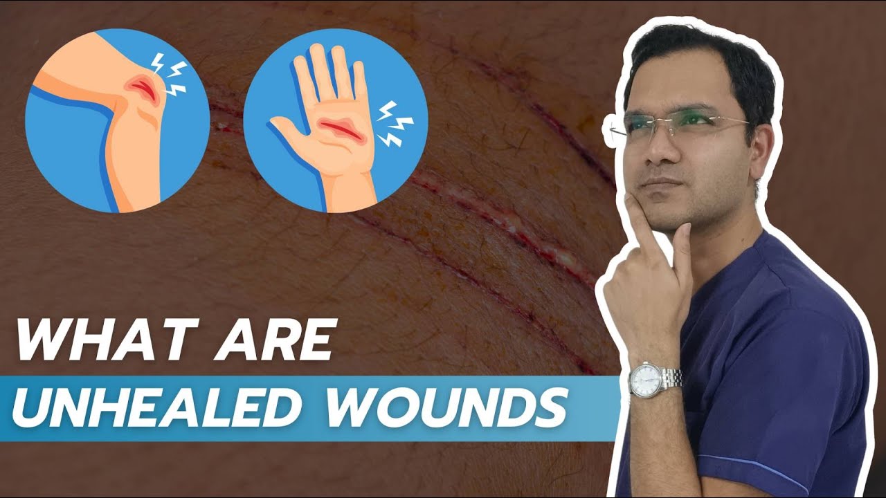 Unhealed Wounds: Understanding and Managing Chronic Vascular Issues | Onestop Vascular Solution