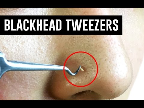 Mee-eter Pincet – Hygiënisch & Effectief voor Zuivere Huid Blackhead Tweezer Mee-eter-pincet van RVS