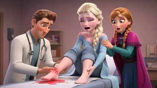 Download lagu 😱💥WHAT HAPPENED TO ELSA’S LEG?🦴❤️‍🩹!anna freezes in shock, not knowing what to do ❄️😰 mp3