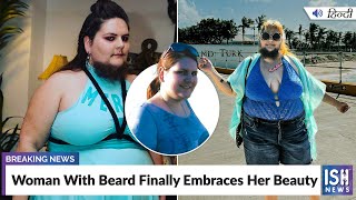 Woman With Beard Finally Embraces Her Beauty
