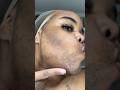 10 5 Face Wax With Me Using Tresswellness Waxing Tresswellness Underarmwax Pcoswax Wax
