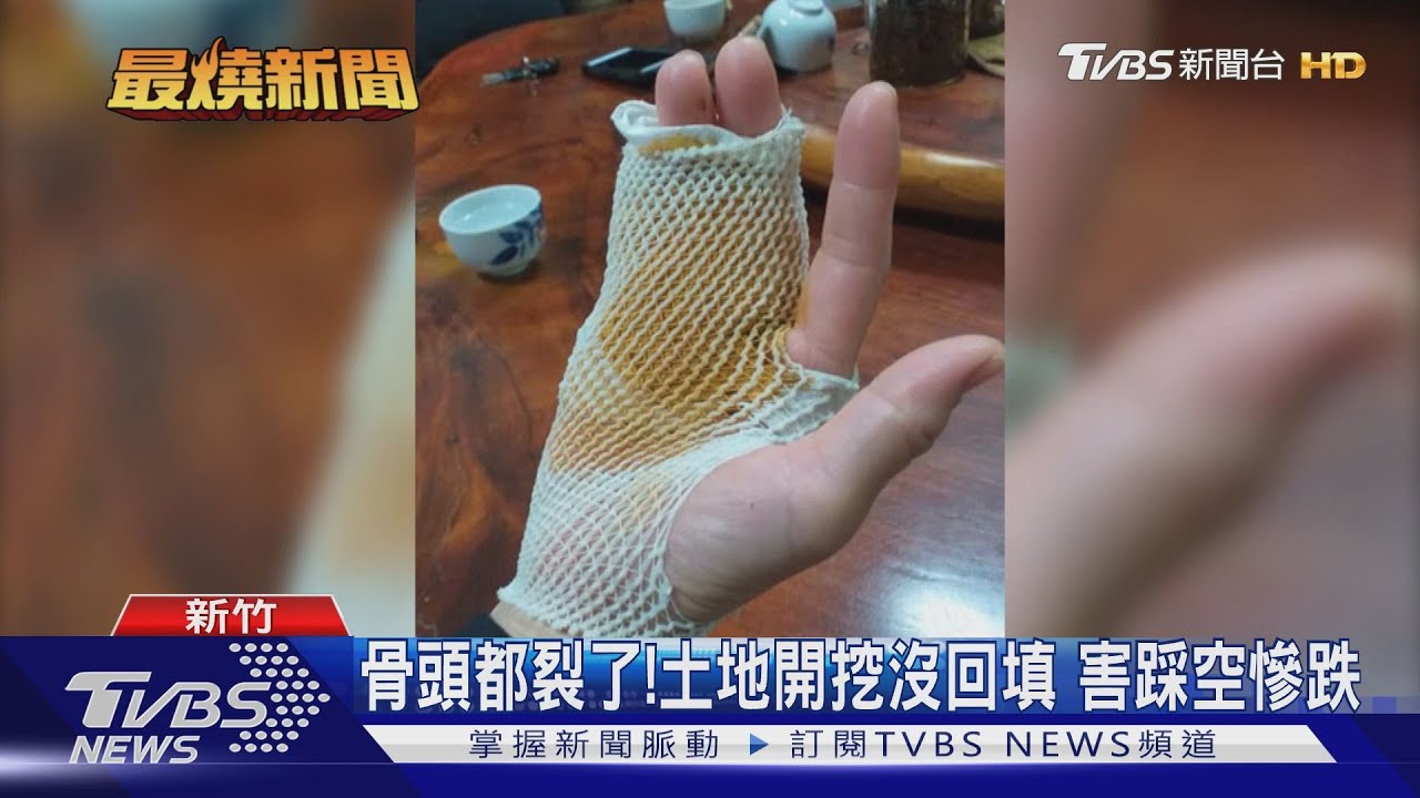 骨頭都裂了!土地開挖沒回填 害踩空慘跌
