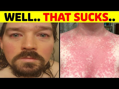 Photos of People Having a Really Bad Day