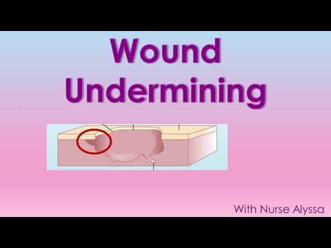 Undermining: what you should know