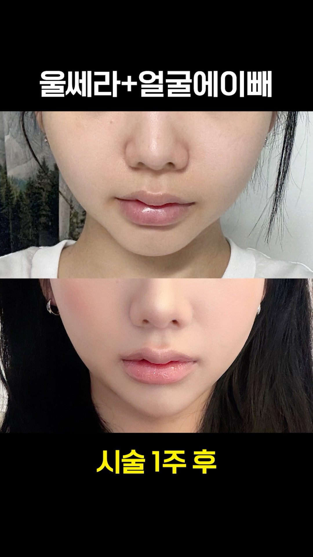 얼굴 윤곽 한 번에 잡는 방법💫