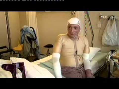 Saunomisen MM onnettomuus