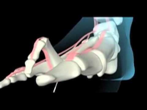 Chirurgia dellanca Krasnoyarsk Massaggio al miele sulle articolazioni del ginocchio