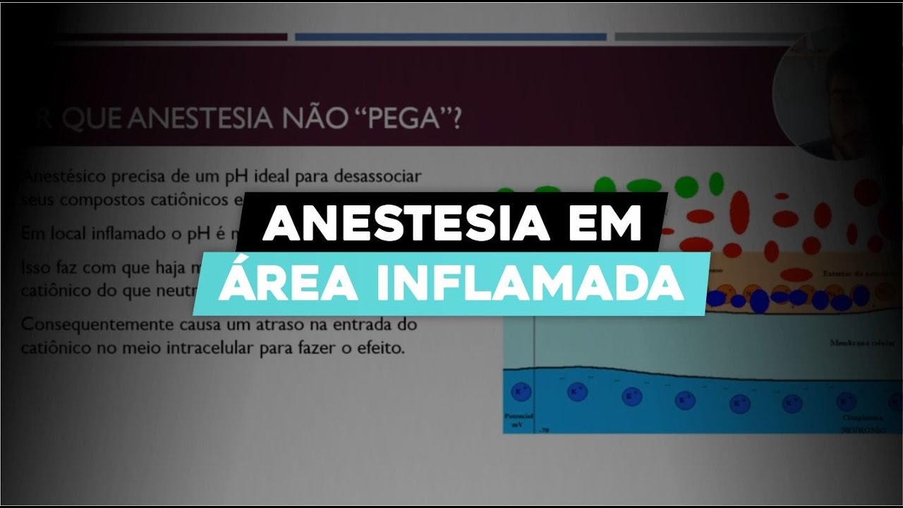 Por Que a Anestesia Não Funciona em Áreas Inflamadas? Aprenda a Corrigir!