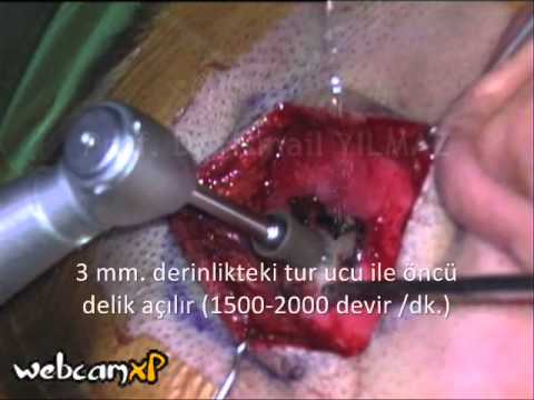 download lagu mp3 mp4 Bursa Iitme Cihaz Fiyatlar, download lagu Bursa Iitme Cihaz Fiyatlar gratis, unduh video klip Bursa Iitme Cihaz Fiyatlar