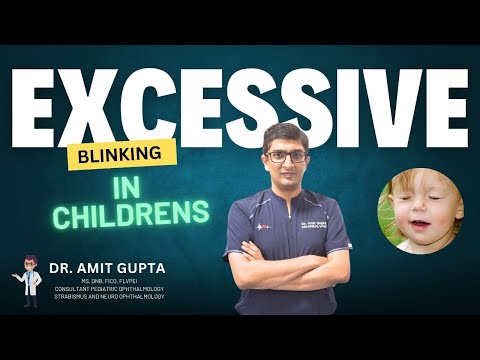 Excessive Blinking in Kids | Treatment, Causes and Symptoms | Why does a child blink excessively?