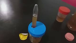 Recolección de Orina en tubo al vacio con preservador BD