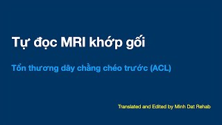 Tự đọc MRI khớp gối: Tổn thương dây chằng chéo trước