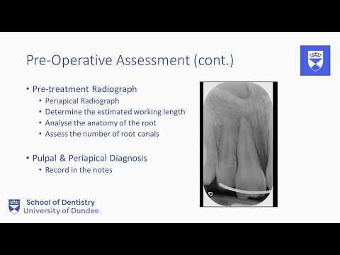 Endodontic treatment of the single rooted tooth. Part 1:  Pre-operative assessment