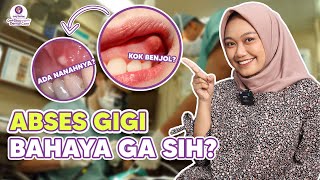 Download lagu THERE'S A PUS-FILLED LUMP ON YOUR GUM, JOY? TURNS OUT THIS IS THE CAUSE. mp3 Download lagu THERE'S A PUS-FILLED LUMP ON YOUR GUM, JOY? TURNS OUT THIS IS THE CAUSE. mp3