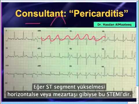 Mattu EKG Vakası - Nisan 8, 2013 - Türkçe Altyazılı