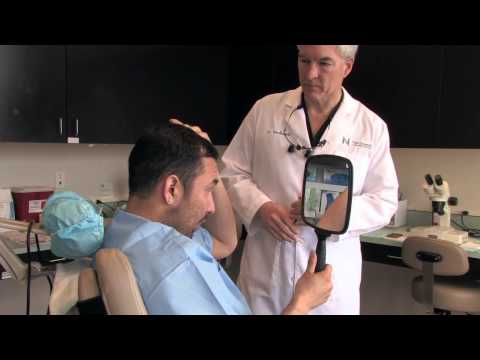Marcus: Hair Transplant Procedure - April 2015