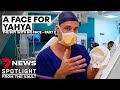 A face for Yahya: the boy with no face (Part II) | 7NEWS Spotlight
