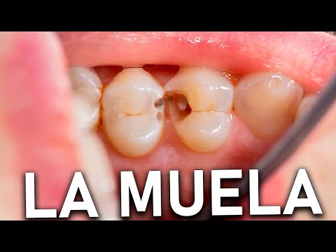 LA MUELA DEL JAIME! Lo Mejor del GOTH en Español - GOTH