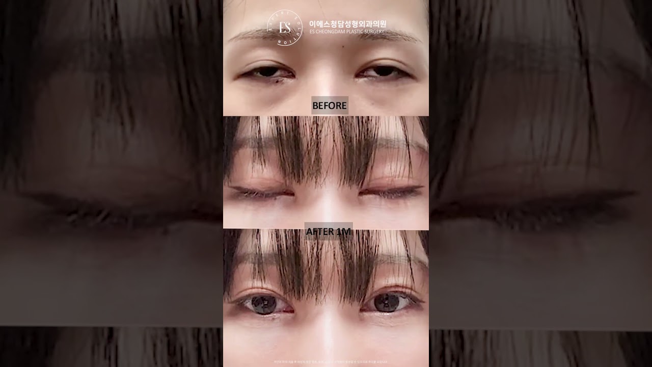 이에스 유튜브