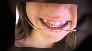preview picture of video 'Top|Pediatric Dentist|423-396-4222|Collegedale|Tennessee|37315|Children Dentist|TN'