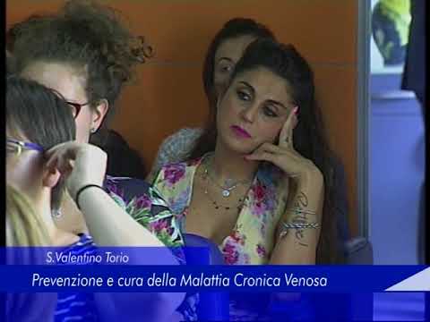 Acquistare candele per prostatite Un mezzo più efficace per BPH