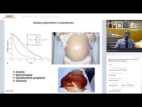 SSBMT Webinar Series - How I Treat Primary Myelofibrosis with Prof. Ayalew Tefferi - 4 July 2020