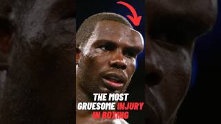 The Most Gruesome Injury In Boxing