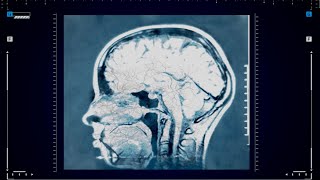 [音樂] 神經元 - 台大醫學 Freestyle/白色巨塔