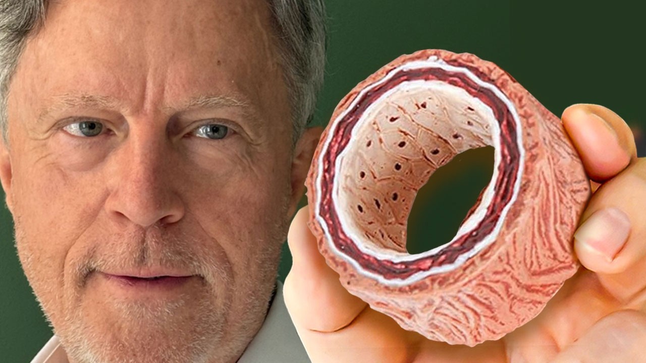 #1 Absolute Best Way to Unclog Arteries