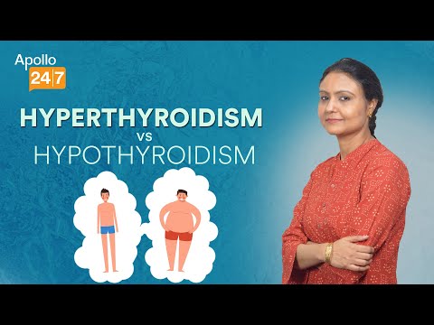 How to Get Rid of Warts Masse Dr Srabani Ghosh Zoha