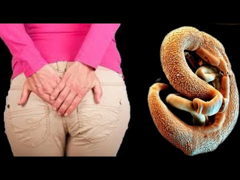 Der Körper selbst wird tote Parasiten ausspucken! Das beste natürliche Heilmittel gegen Parasiten!🔥