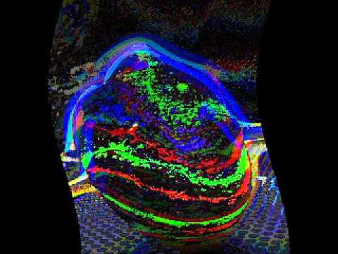 Arty & Mat Zo vs. Avicii - Rebound Levels (Ken Loi Mashup)