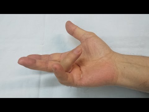 Artroza la maini