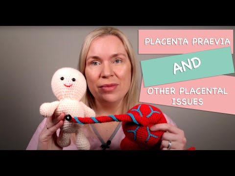 Placenta Praevia(previa)/low lying placenta, placental abruption and more