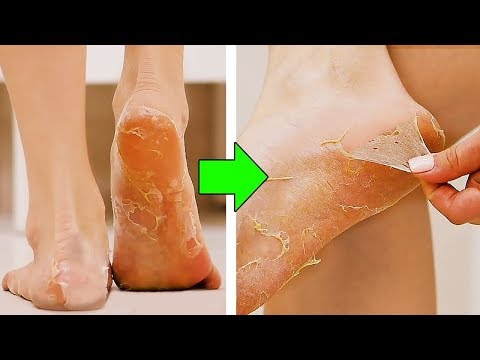 29 GENIALE BEAUTY TRICKS, DIE DU KENNEN MUSST