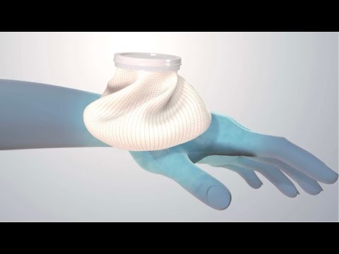 Osteoarthritis of the Thumb: Nonsurgical Treatments