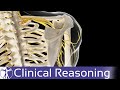 Does Your Patient Really Have Thoracic Outlet Syndrome TOS