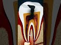 Why Grinding Your Teeth Is Bad 😱